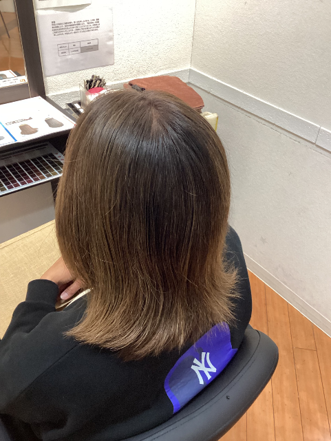 施術例　アフター1