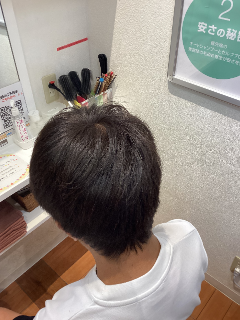 施術例　アフター5