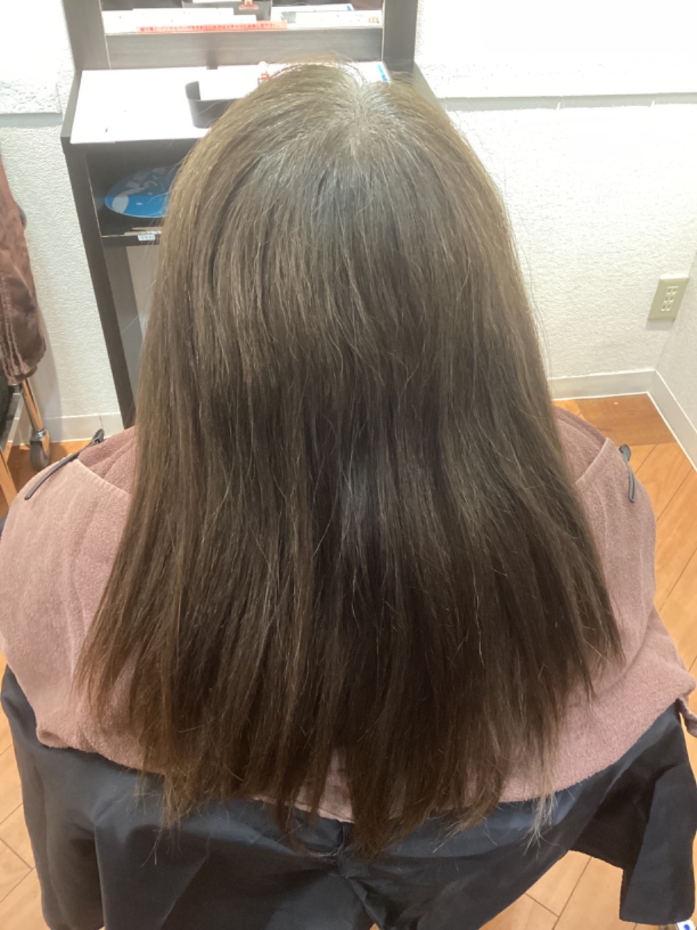 施術例　ビフォー3