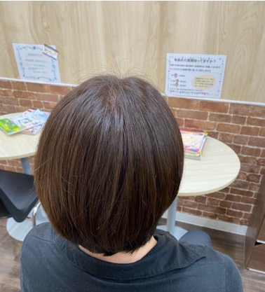 施術例　アフター1