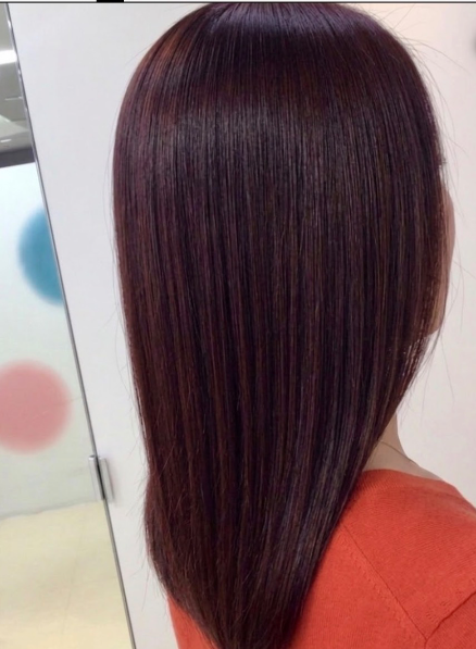 施術例　アフター3