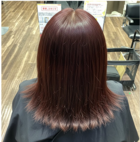 施術例　アフター1