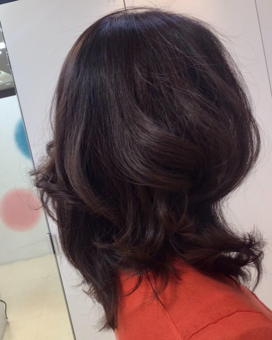 施術例　ビフォー3