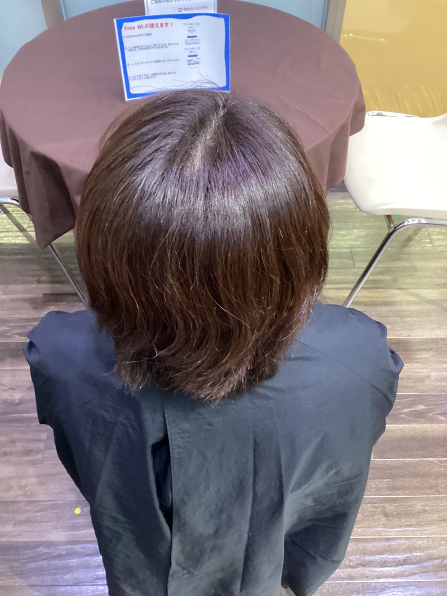 施術例　ビフォー1