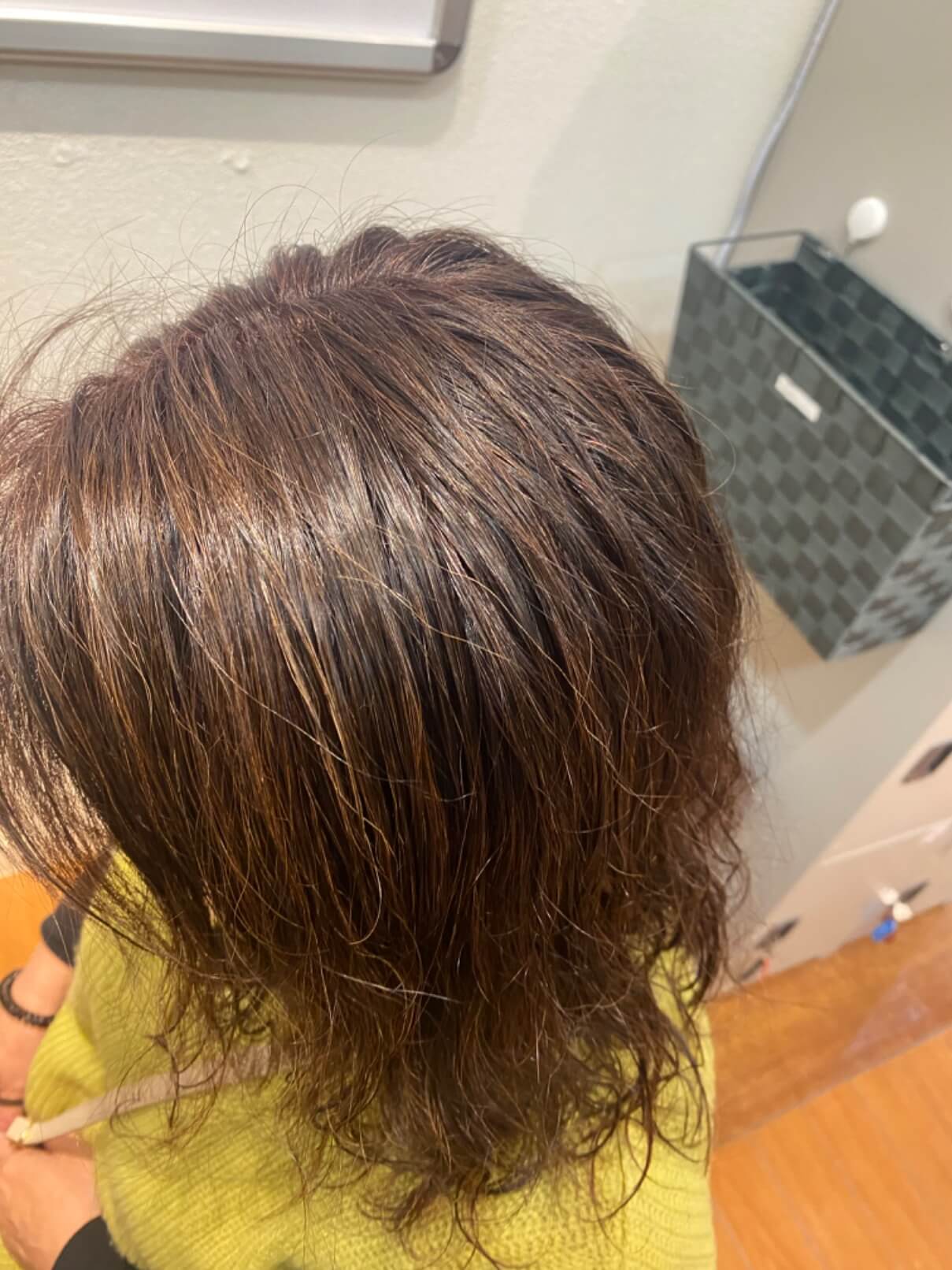 施術例　アフター1