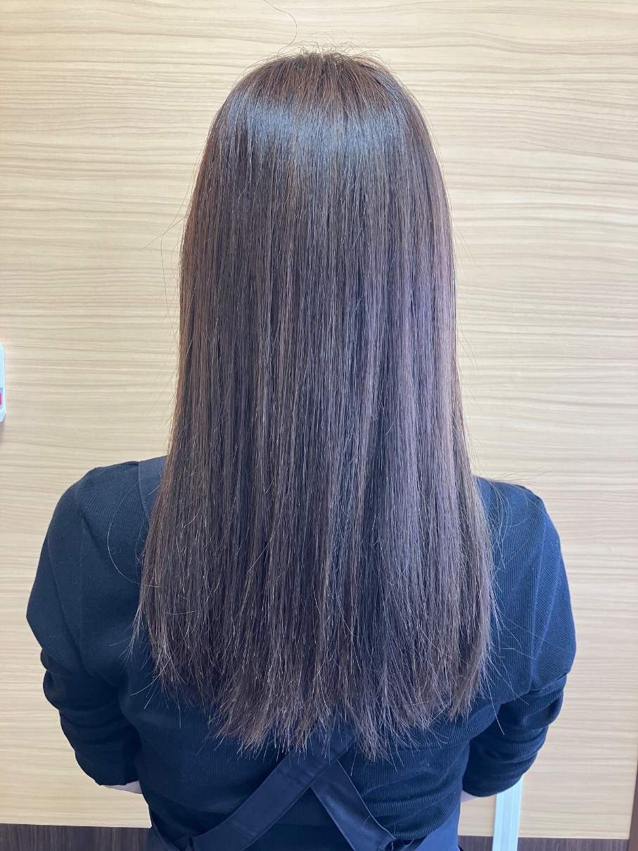 施術例　ビフォー3