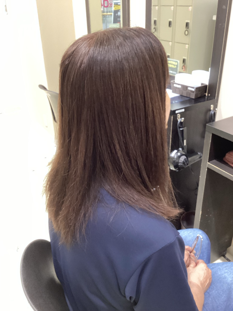 施術例　ビフォー2