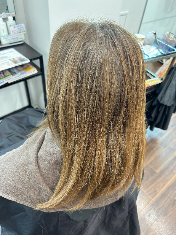 施術例　ビフォー1